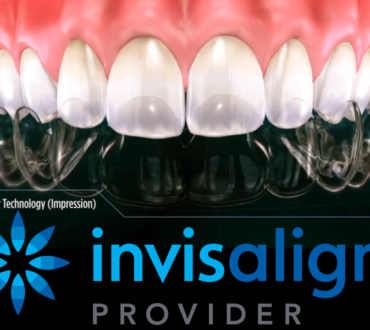 INVISALIGN