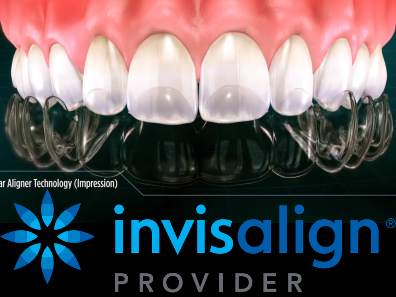 INVISALIGN